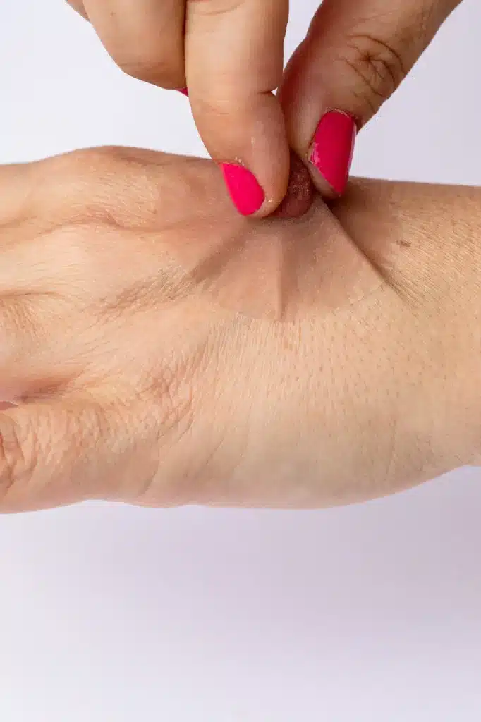 sticky and realistic prosthetic nipples, no surgery needed, blends into the skin